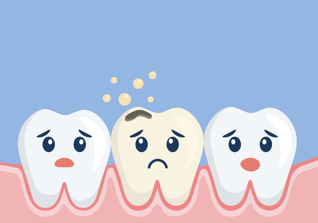 Dreamsmile Surgery