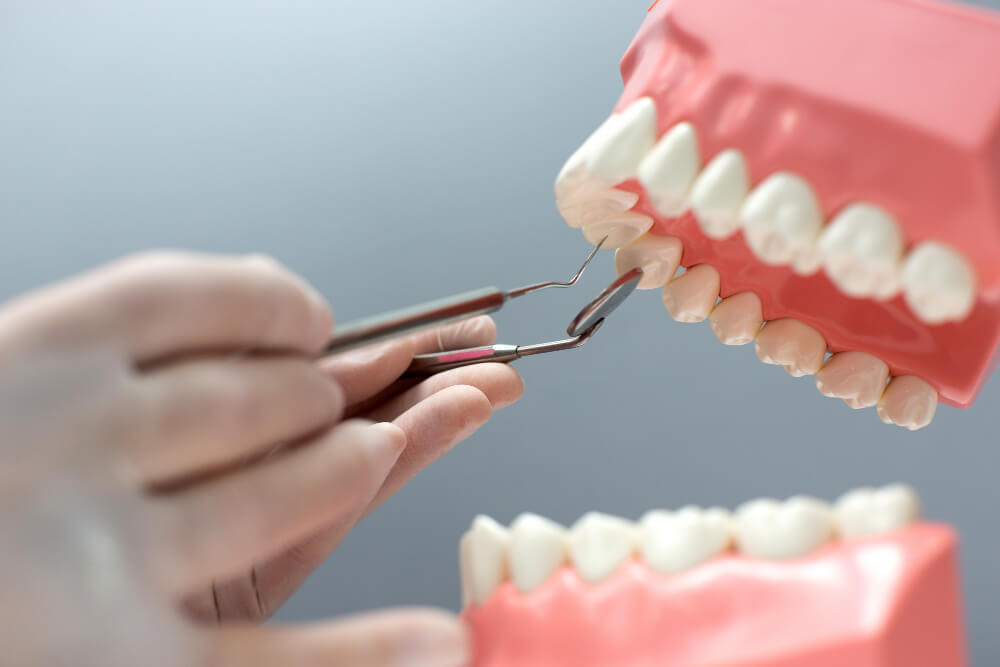 Tooth Structure Model