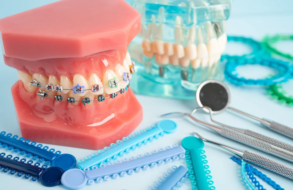 เชนจัดฟัน