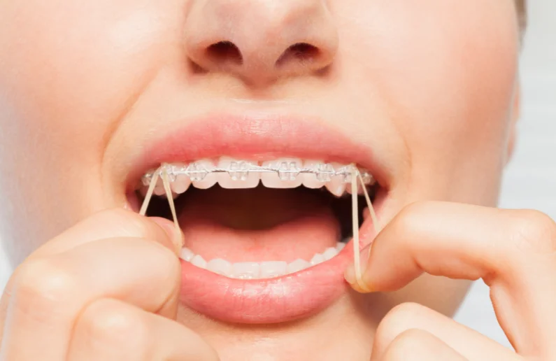 สีต้องห้าม