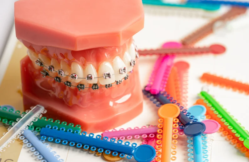 สียางจัดฟัน