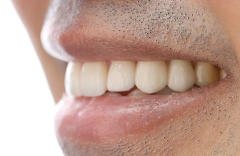 รีวิววีเนียร์